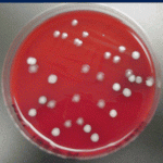 Microbobial limit tests- bacteria colonies on tsa with sheep blood