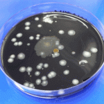 Legionella colonies