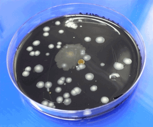Legionella colonies