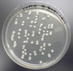 Environmental bacteria testing- colonies on TSA